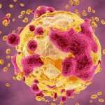 روش های پیشگیری از سرطان