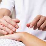 آموزش طب سوزنی زیبایی