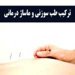 ترکیب طب سوزنی و ماساژ درمانی
