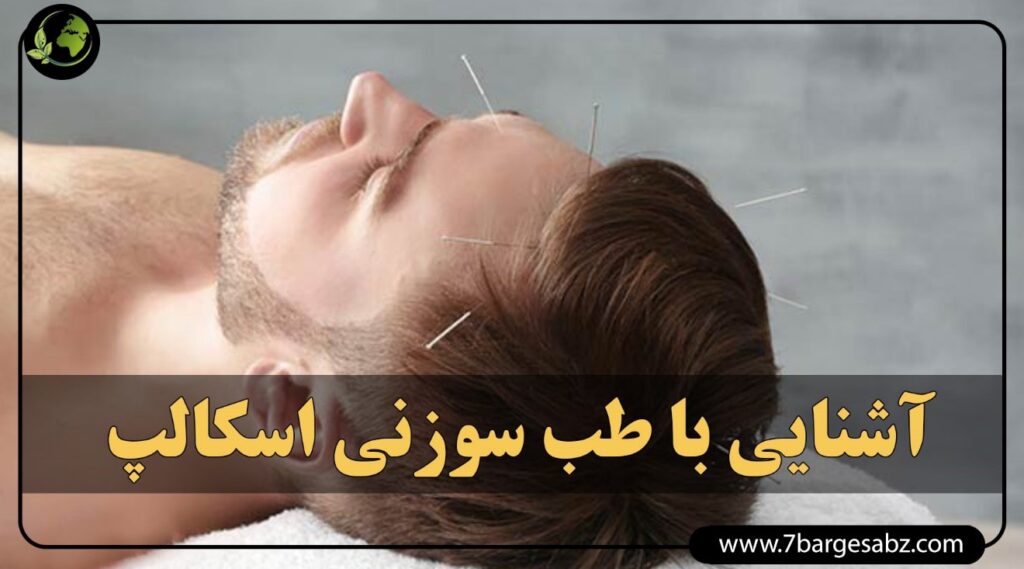 اموزش طب سوزنی اسکالپ